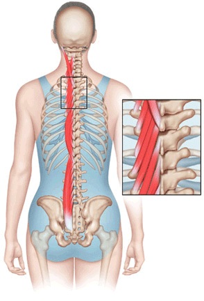 paraspinal-muscles paraspinal-muscles